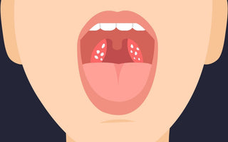 Can an Oral Irrigator Remove Tonsil Stones?
