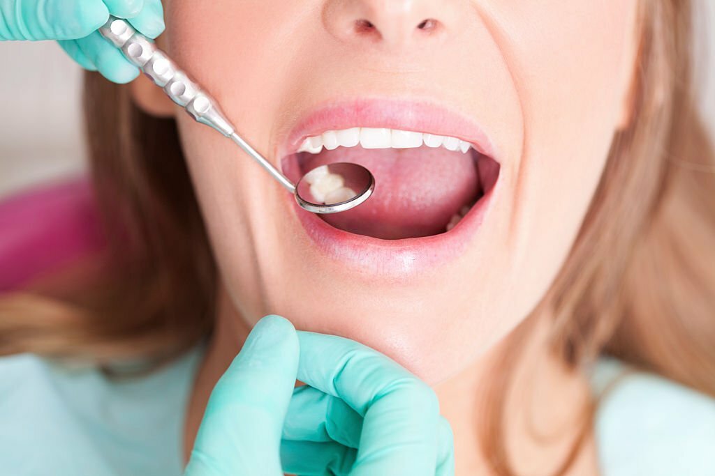 How to prevent cavities from getting worse