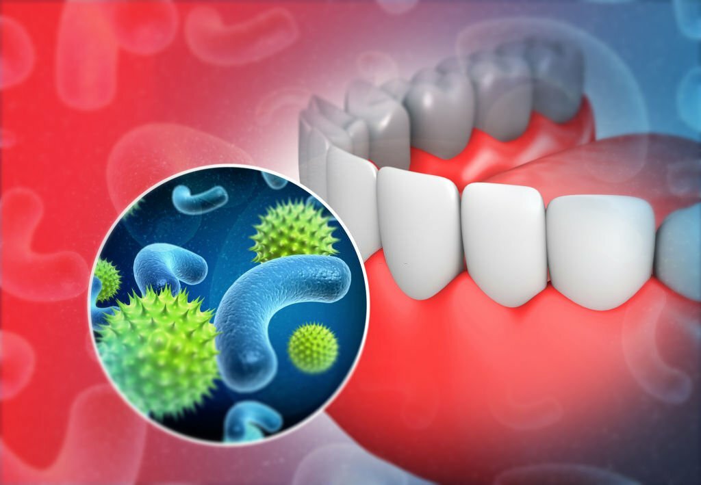 Can a Tooth Infection Kill You?